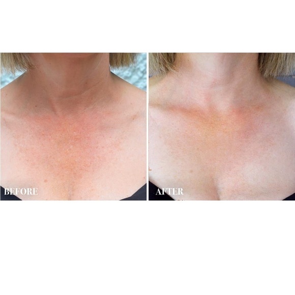 NECK And Decollete Firming Cream - Picture 2 of 4